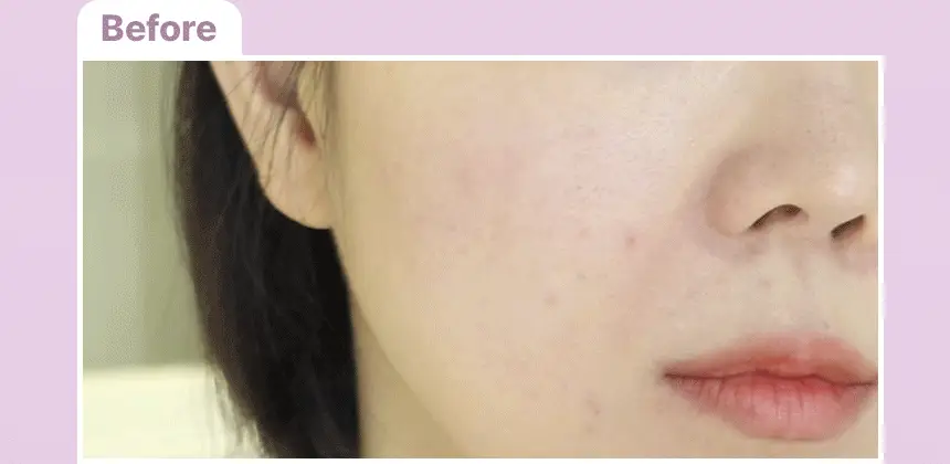 [3월 신상] 아넷사 브라이트닝 UV 선스크린 젤 NA 90g 상세페이지 8